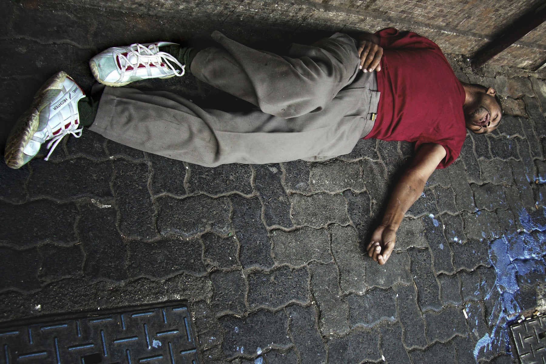 Mengenal Epilepsi: Penyakit Saraf yang Sering Disalahpahami