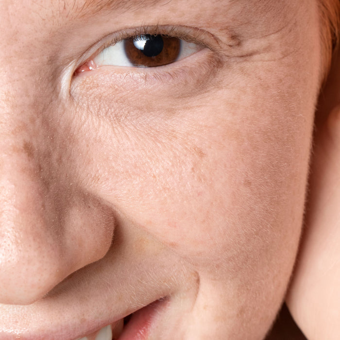 Mengatasi Kulit Kering : Tips dan Perawatan untuk Kulit yang Sehat dan Lembap